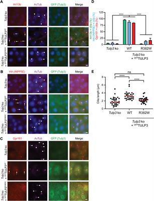 A pathogenic variant of TULP3 causes renal and hepatic fibrocystic disease